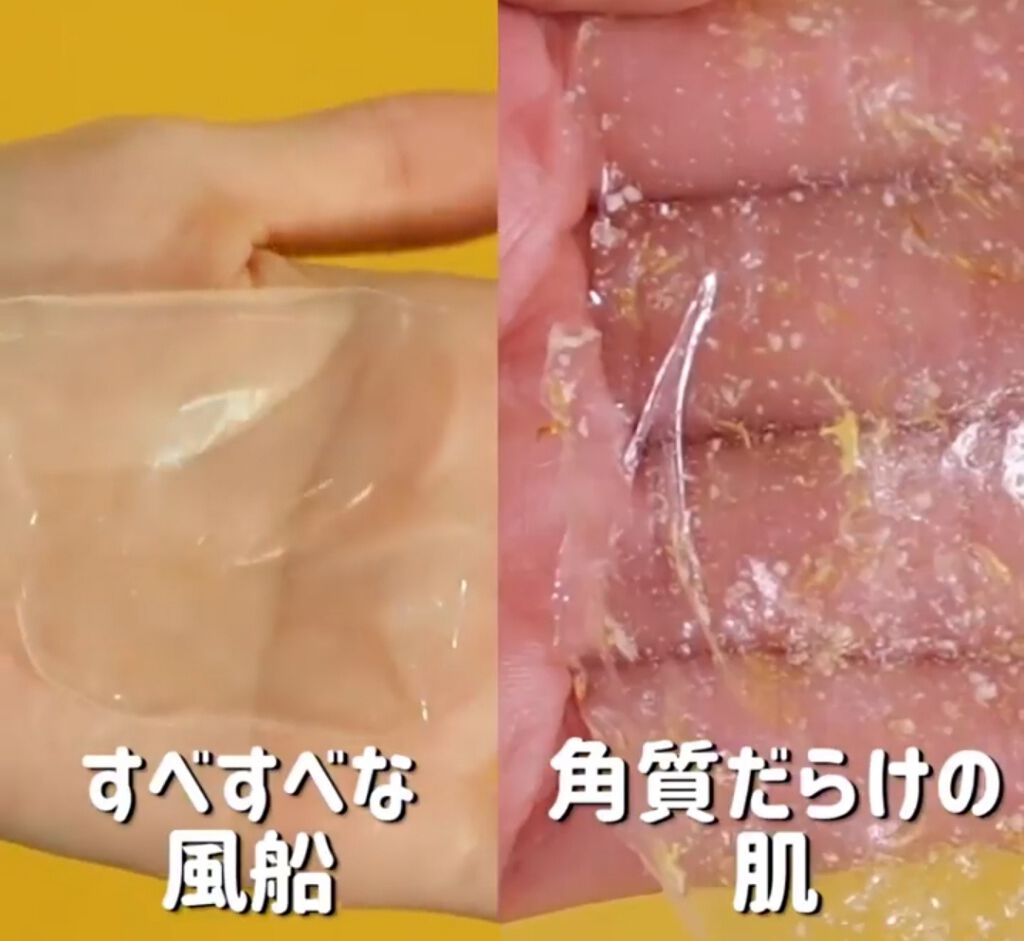 リアルカレンデュラピールオフパック/APRILSKIN/ピーリングを使ったクチコミ(3枚目)