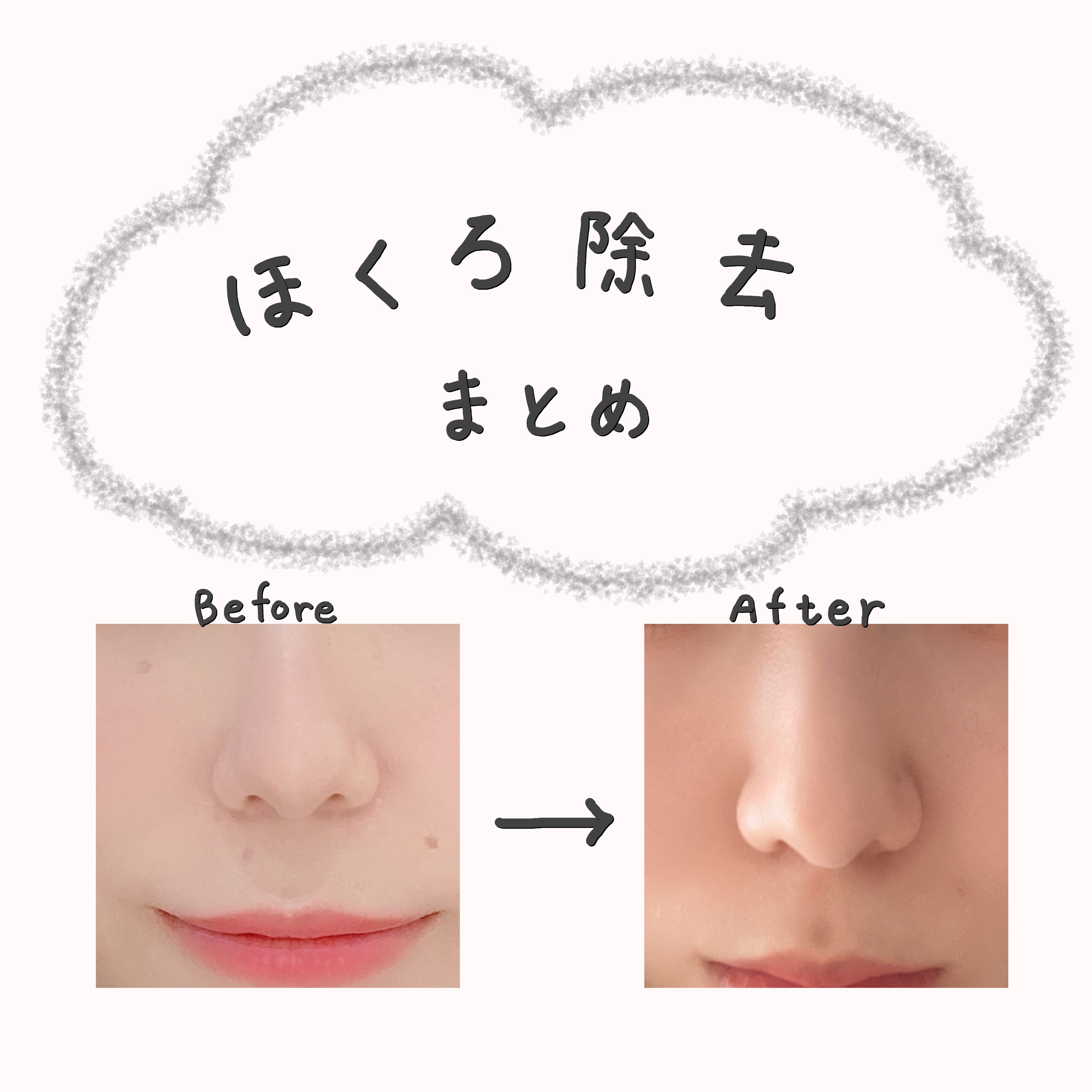 白潤プレミアム 薬用浸透美白乳液/肌ラボ/乳液を使ったクチコミ（1枚目）