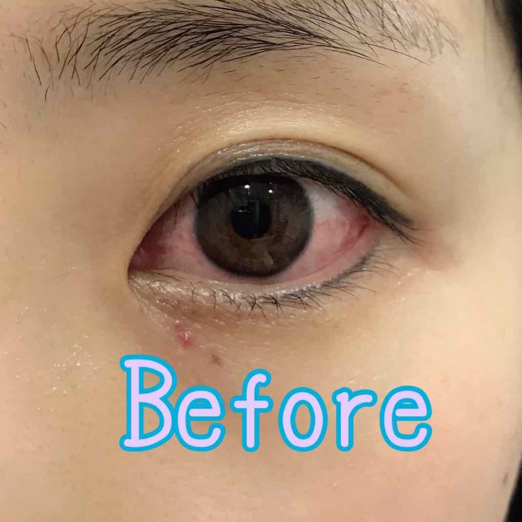 サンテ ボーティエ(医薬品)/参天製薬/その他を使ったクチコミ（2枚目）