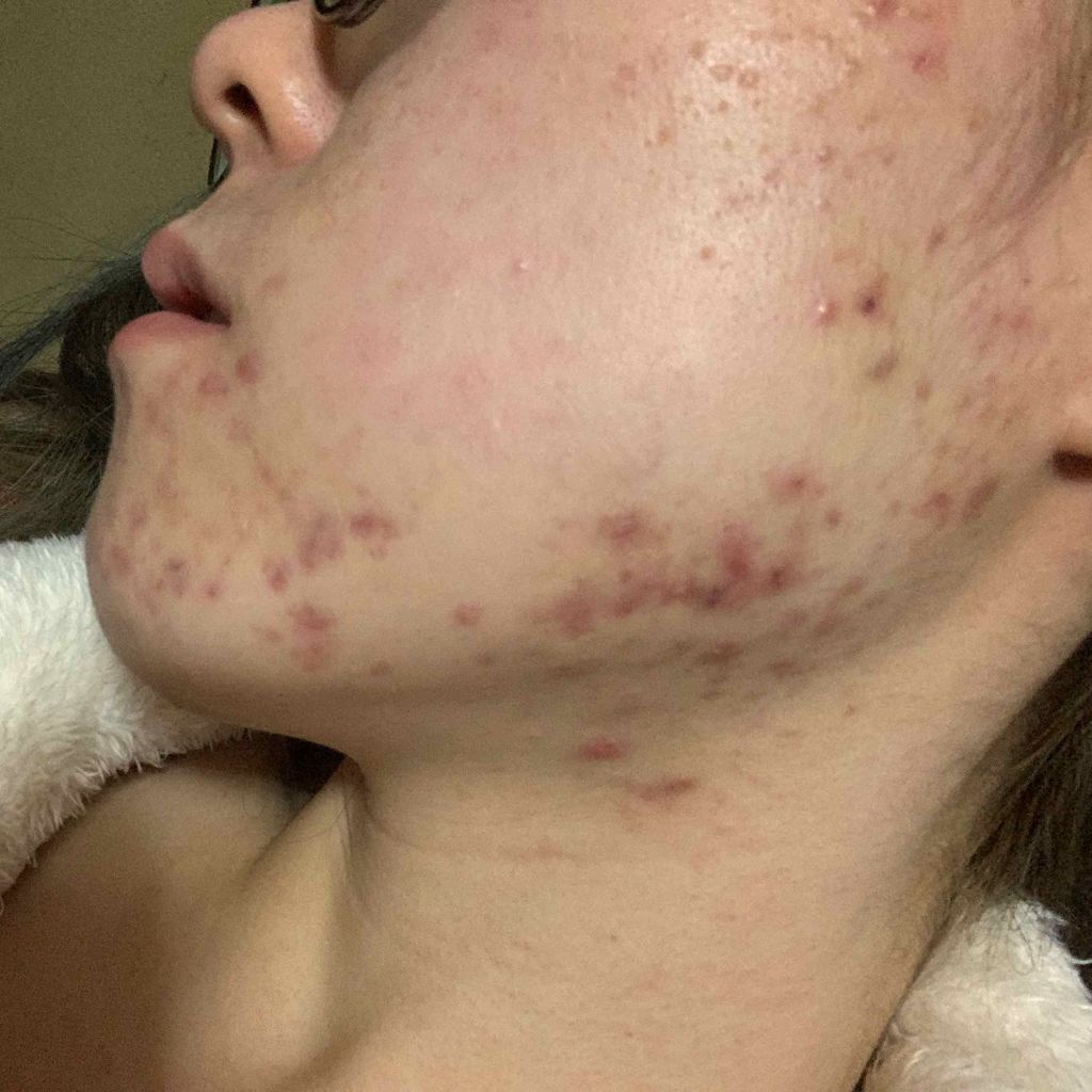 明色美顔水 薬用化粧水/美顔/化粧水を使ったクチコミ（2枚目）