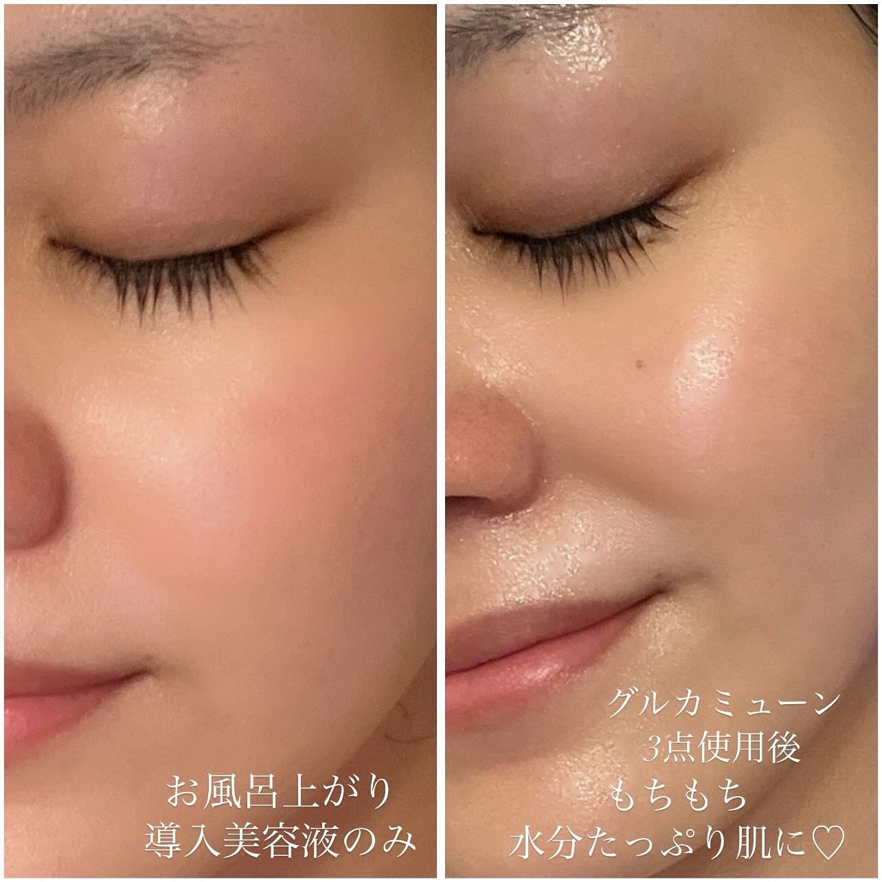 グルカミューンクリーム/VT/フェイスクリームを使ったクチコミ(5枚目)