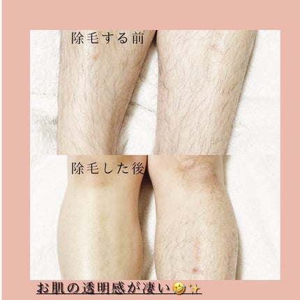 パイナップル豆乳除毛クリーム/鈴木ハーブ研究所/除毛クリームを使ったクチコミ(8枚目)