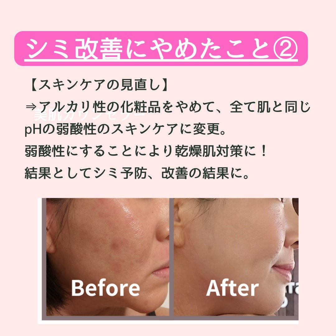 美肌カウンセラー💆肌悩みを解決し見る世界を変える on LIPS 「肌を綺麗にする専門家💆肌荒れ難民族だったわたしが"シミ改善のた..」(4枚目)