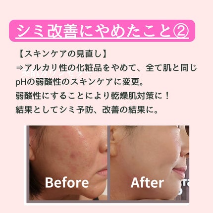 美肌カウンセラー💆肌悩みを解決し見る世界を変える on LIPS 「肌を綺麗にする専門家💆肌荒れ難民族だったわたしが"シミ改善のた..」(4枚目)
