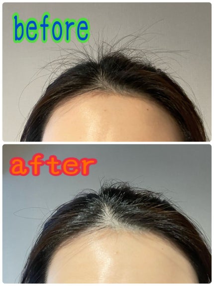 エルジューダ ポイントケアスティック/エルジューダ/ヘアジェルを使ったクチコミ(2枚目)