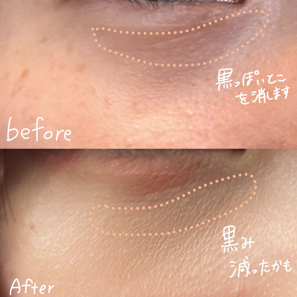 ストレッチコンシーラー/CEZANNE/リキッドコンシーラーを使ったクチコミ（2枚目）