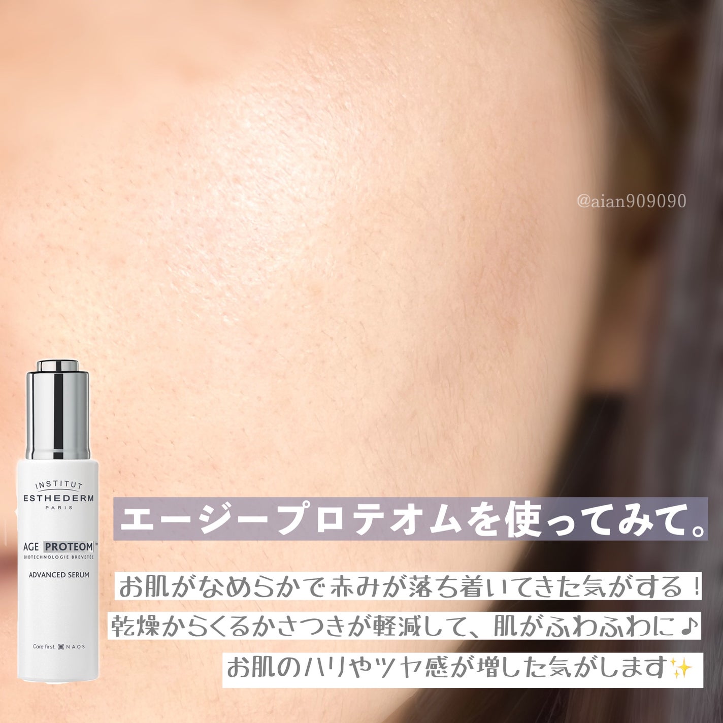 エージプロテオム/エステダム/美容液を使ったクチコミ(5枚目)