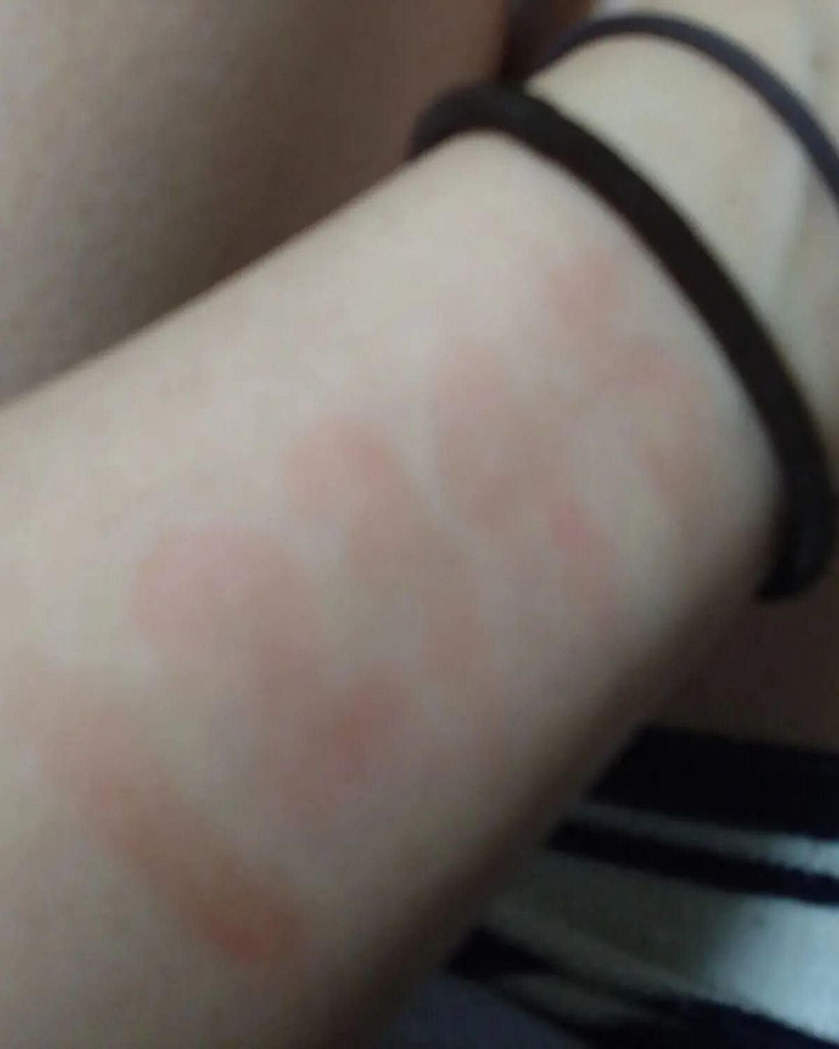 グロウ フィクシングティント/ETUDE/リップティントを使ったクチコミ(3枚目)