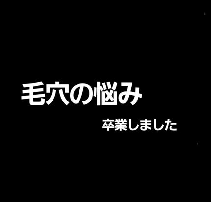 スーパー毛穴ピールセラム/ラボラボ/美容液を使ったクチコミ(1枚目)