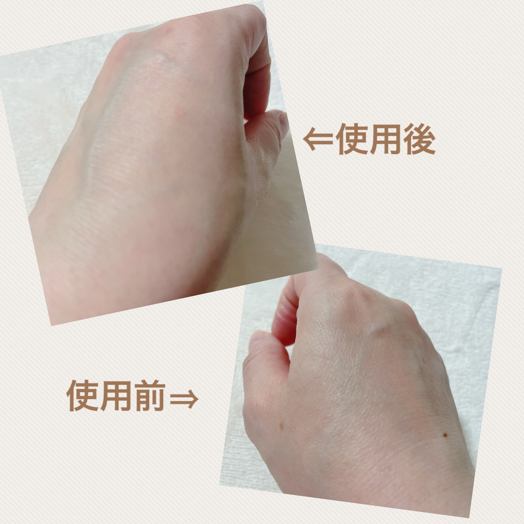 ブライトニングピーリングジェル/Dr.G/ピーリングを使ったクチコミ（3枚目）