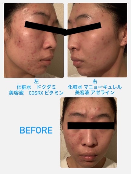 薬用洗顔フォーム しっかりタイプ/クレアラシル/洗顔フォームを使ったクチコミ(1枚目)