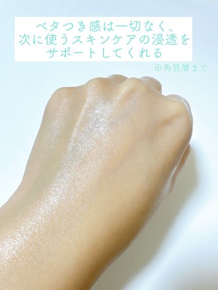 マイクロバブルVCセラム/DSW/美容液を使ったクチコミ(4枚目)