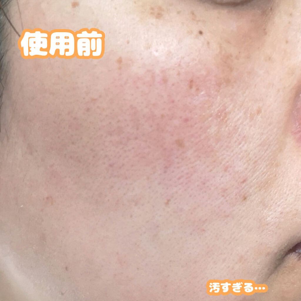 ホワイトニングクリア ローション/d プログラム/化粧水を使ったクチコミ（2枚目）