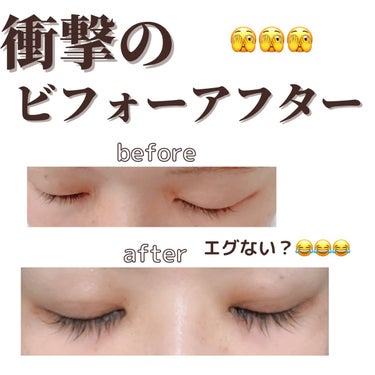 ラッシュアディクト アイラッシュコンディショニングセラム/ラッシュアディクト/まつげ美容液を使ったクチコミ（3枚目）