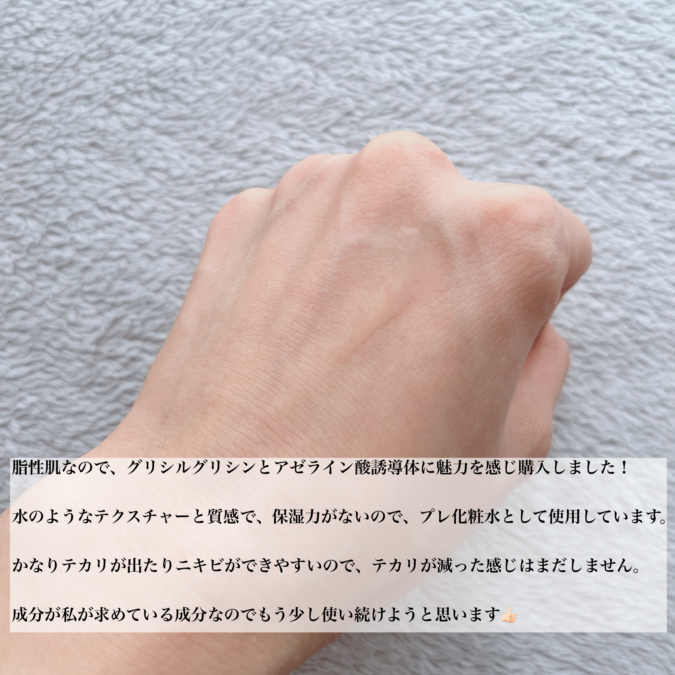 バランシングGAローション/TOUT VERT/化粧水を使ったクチコミ（3枚目）