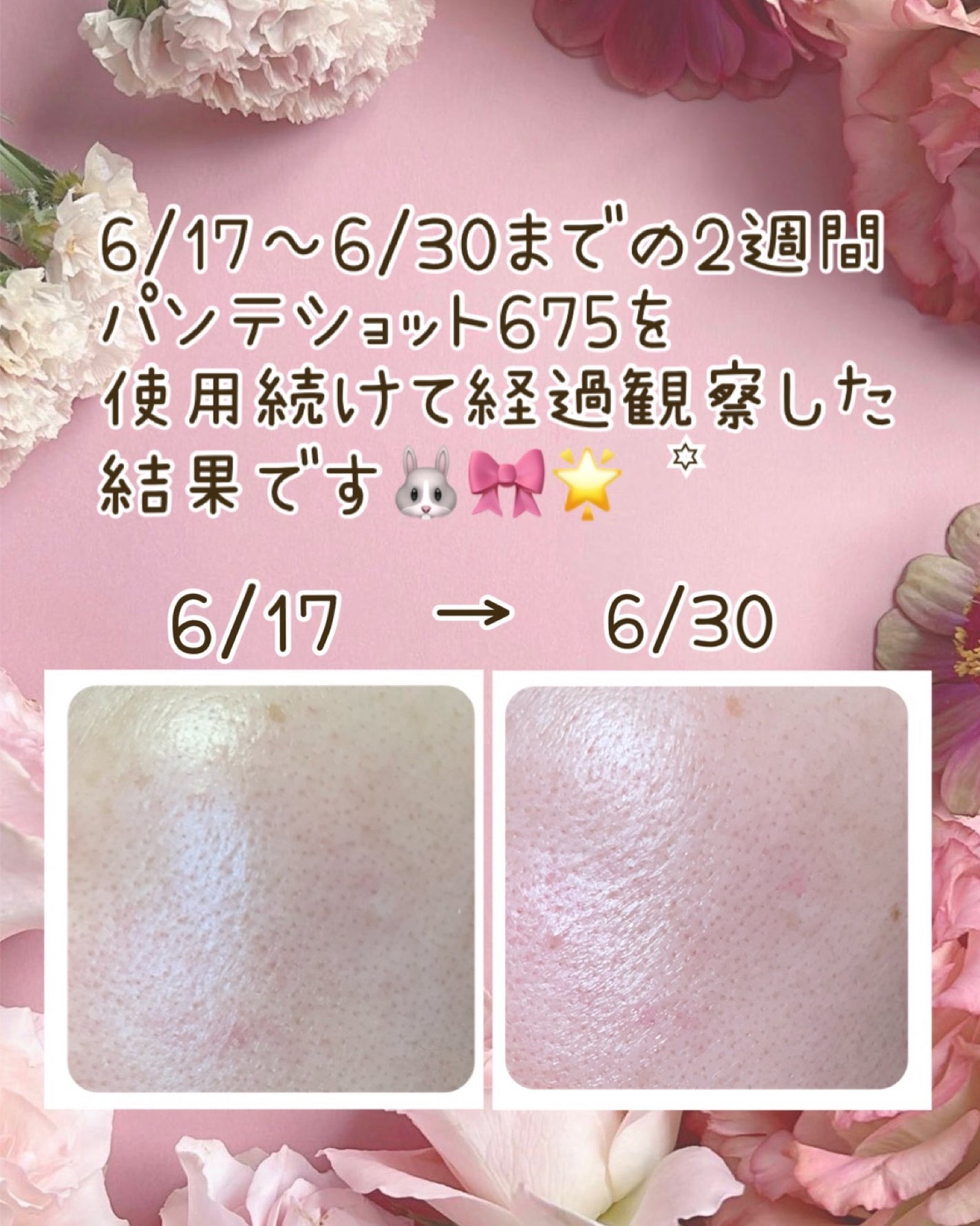 パンテショット675/COSNORI/美容液を使ったクチコミ(3枚目)