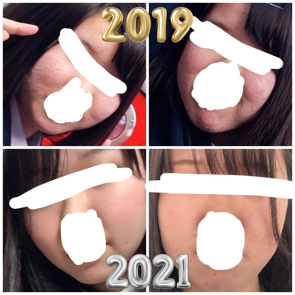 化粧水・敏感肌用・高保湿タイプ/無印良品/化粧水を使ったクチコミ(2枚目)