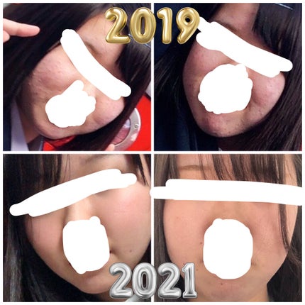 化粧水・敏感肌用・高保湿タイプ/無印良品/化粧水を使ったクチコミ(2枚目)