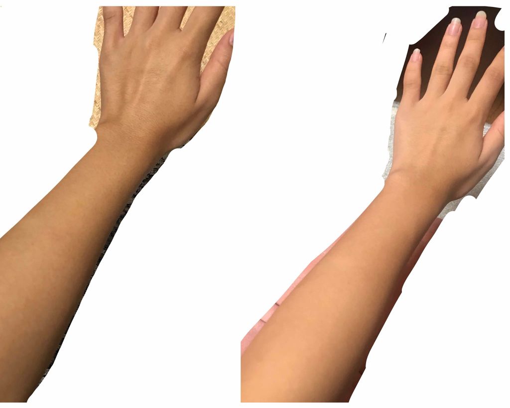 エバレッシュホワイトEXⅡ(医薬品)/matsukiyo/その他を使ったクチコミ(2枚目)