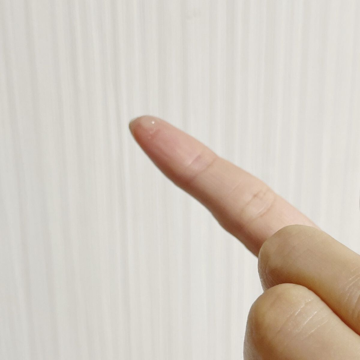 ニキビあとケアジェル/アットノン/その他スキンケアを使ったクチコミ（3枚目）