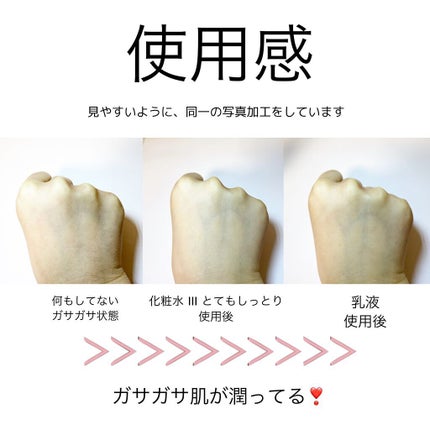 潤浸保湿 化粧水 III とてもしっとり/キュレル/化粧水を使ったクチコミ(2枚目)