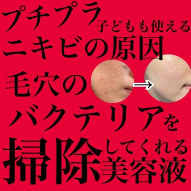 これは、使わな損。
元ニキビ肌の私の精神安定剤といっていい
ニキビ撲滅美容液🧹🦠

それが、
スキンケアヲタであれば知っているであろう、
コスデハバのアゼライン酸10% 美容液！
お値段は（私調べだとメ