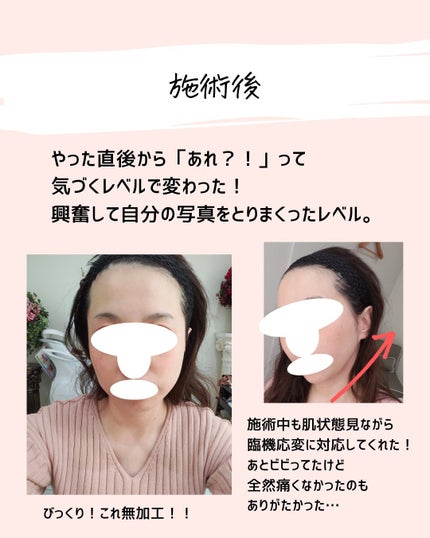 とまと村長@化粧品研究者 on LIPS 「←肌ケアをしたい人はフォロー必須🍅化粧品研究者のとまと村長です..」(6枚目)