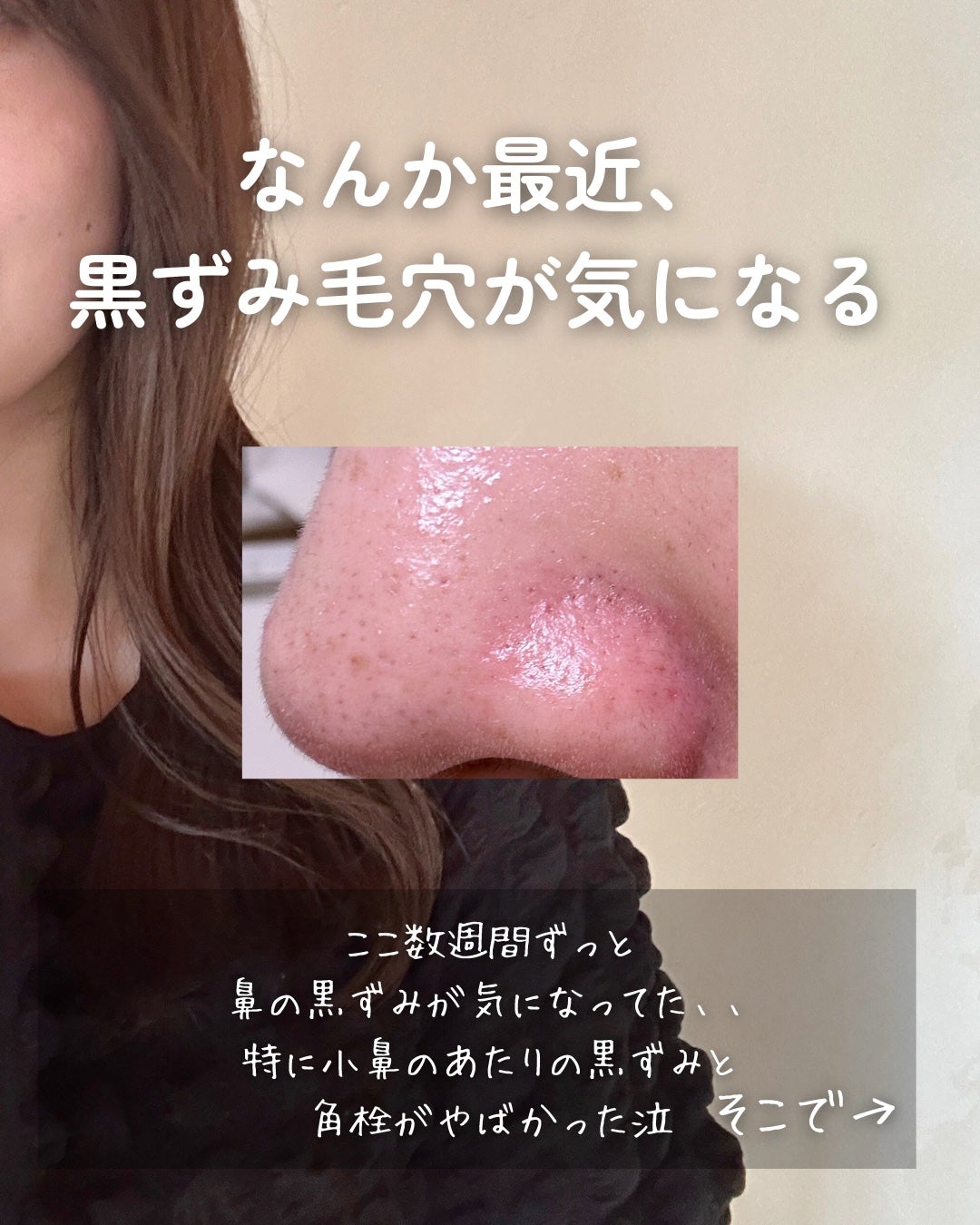 ピュアクレンジングバーム/manyo/クレンジングバームを使ったクチコミ(2枚目)