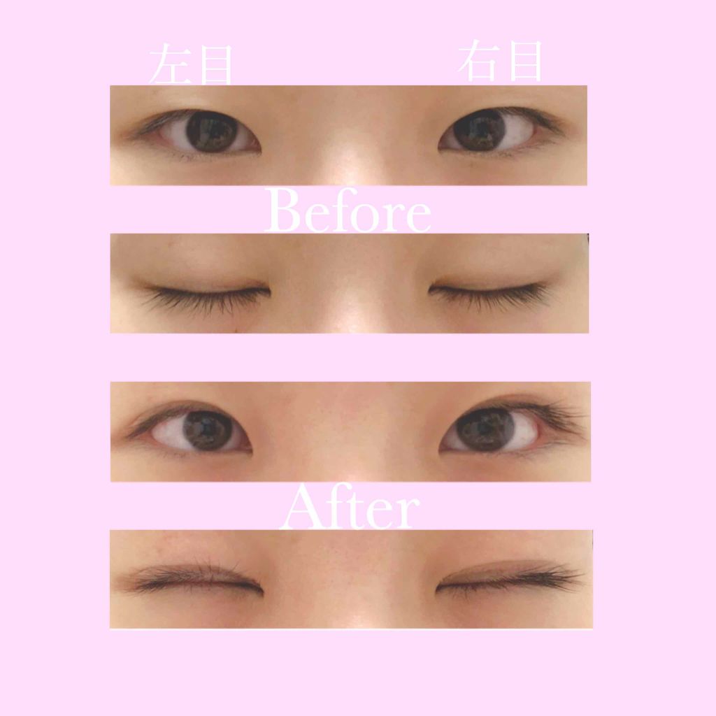 ガールズメーカー エタニティラインα/Girl's Maker/二重まぶた用アイテムを使ったクチコミ(4枚目)