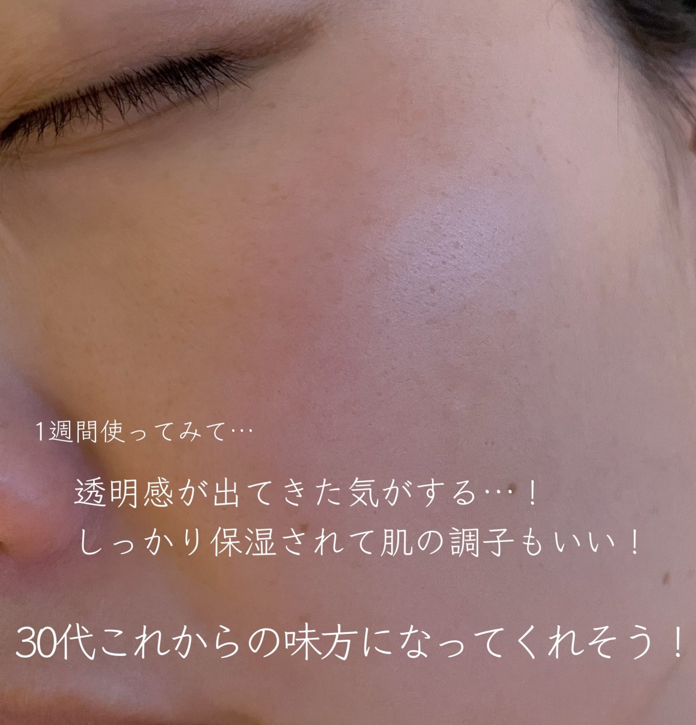 ホワイトロジスト ネオジェネシス ブライトニング コンセントレイト/DECORTÉ/美容液を使ったクチコミ(4枚目)