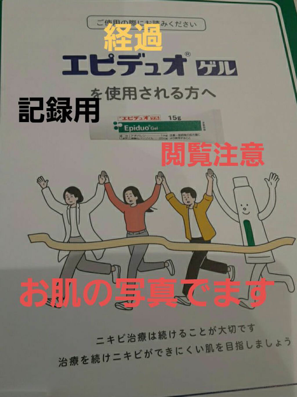 薬用保湿化粧水/オードムーゲ/化粧水を使ったクチコミ（1枚目）