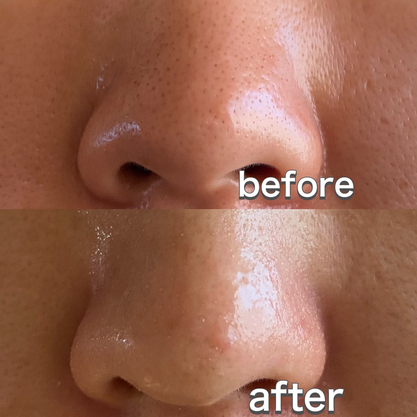 ナチュラルマイルドクリアノーズパック/ilso/シートマスク・パックを使ったクチコミ(5枚目)