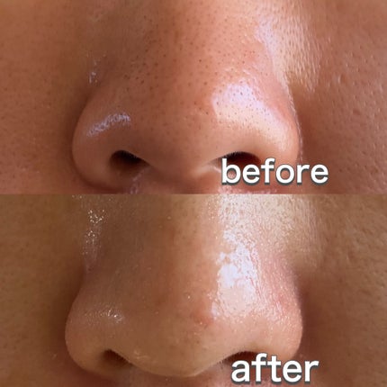 ナチュラルマイルドクリアノーズパック/ilso/シートマスク・パックを使ったクチコミ(5枚目)