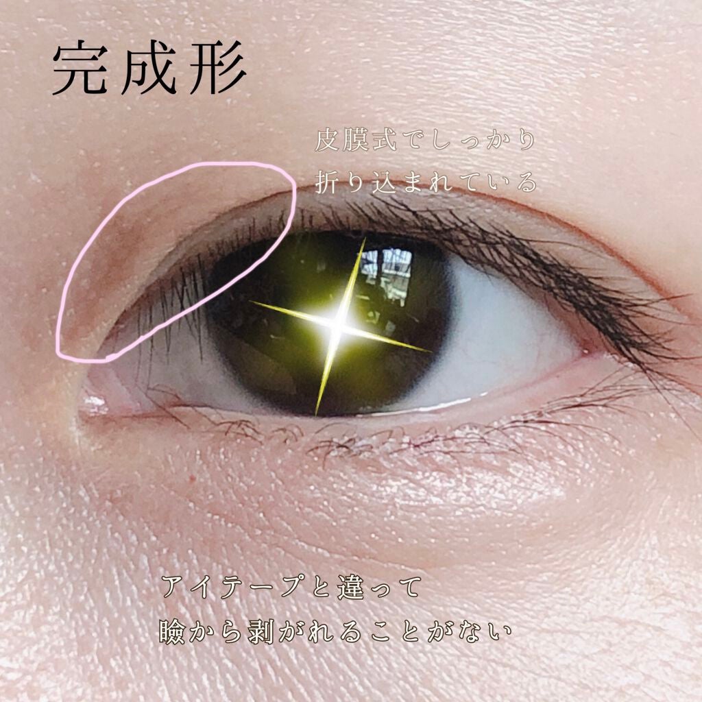 ハイブリッドフィルム スーパーマット/アイトーク/二重まぶた用アイテムを使ったクチコミ(2枚目)