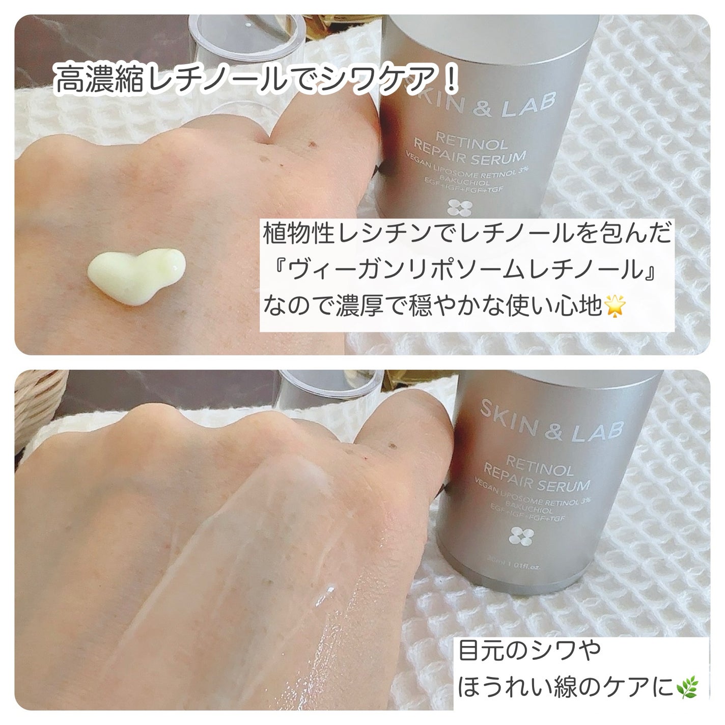 バリアダームモイストクリーム/SKIN&LAB/フェイスクリームを使ったクチコミ(5枚目)