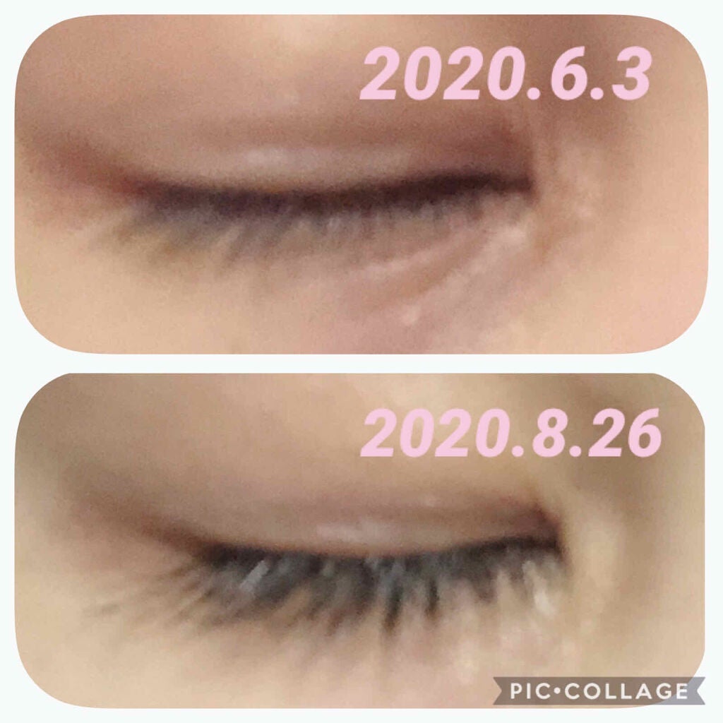 EMAKED(エマーキット)/水橋保寿堂製薬/まつげ美容液を使ったクチコミ(1枚目)