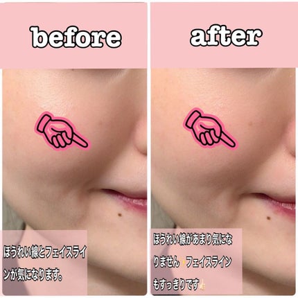 イオン導入美顔器フォトマックス /ar&ar /美顔器・マッサージを使ったクチコミ(6枚目)