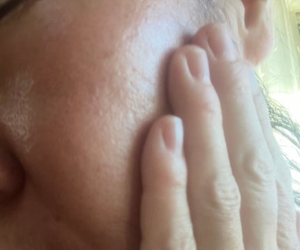 ざくろ ファーミングローション EX/WELEDA/化粧水を使ったクチコミ(5枚目)