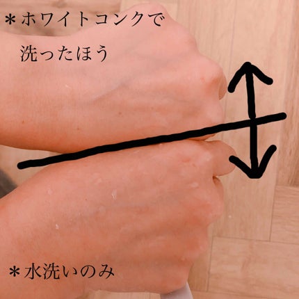 薬用ホワイトコンク ボディシャンプーC II/ホワイトコンク/ボディソープを使ったクチコミ(3枚目)