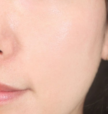 ボツルショット 300/CELLINSHOT/ブースター・導入液を使ったクチコミ（2枚目）