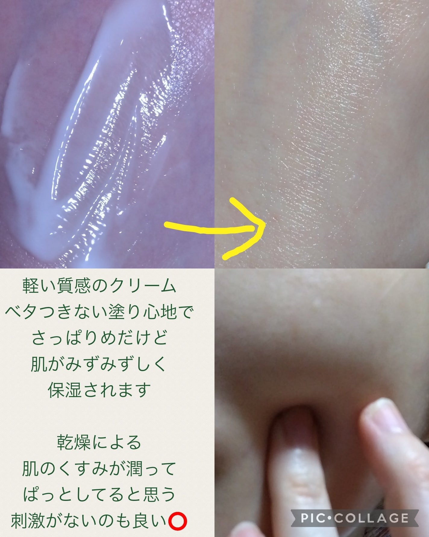 ビタシューティカル7+ラディアンスクリーム/Dr.G/フェイスクリームを使ったクチコミ(3枚目)