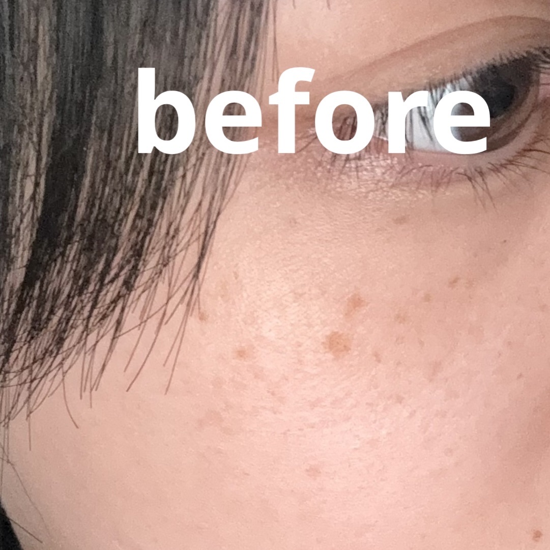 ディオールスキン フォーエヴァー スキン コレクト コンシーラー/Dior/リキッドコンシーラーを使ったクチコミ（2枚目）