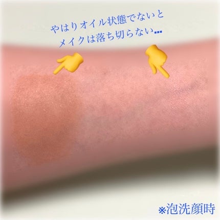 TX-アンプルクレンザー/Dr.Melaxin/美容液を使ったクチコミ(7枚目)