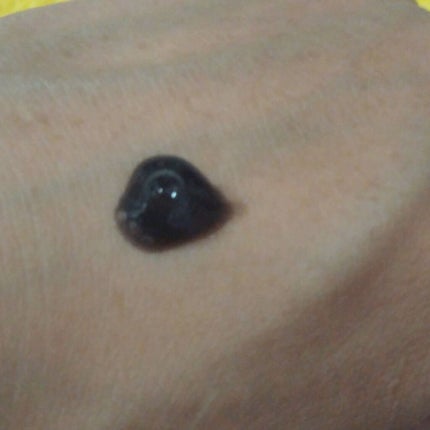 JUSO COOL PACK/NAKUNA-RE/洗い流すパック・マスクを使ったクチコミ(3枚目)