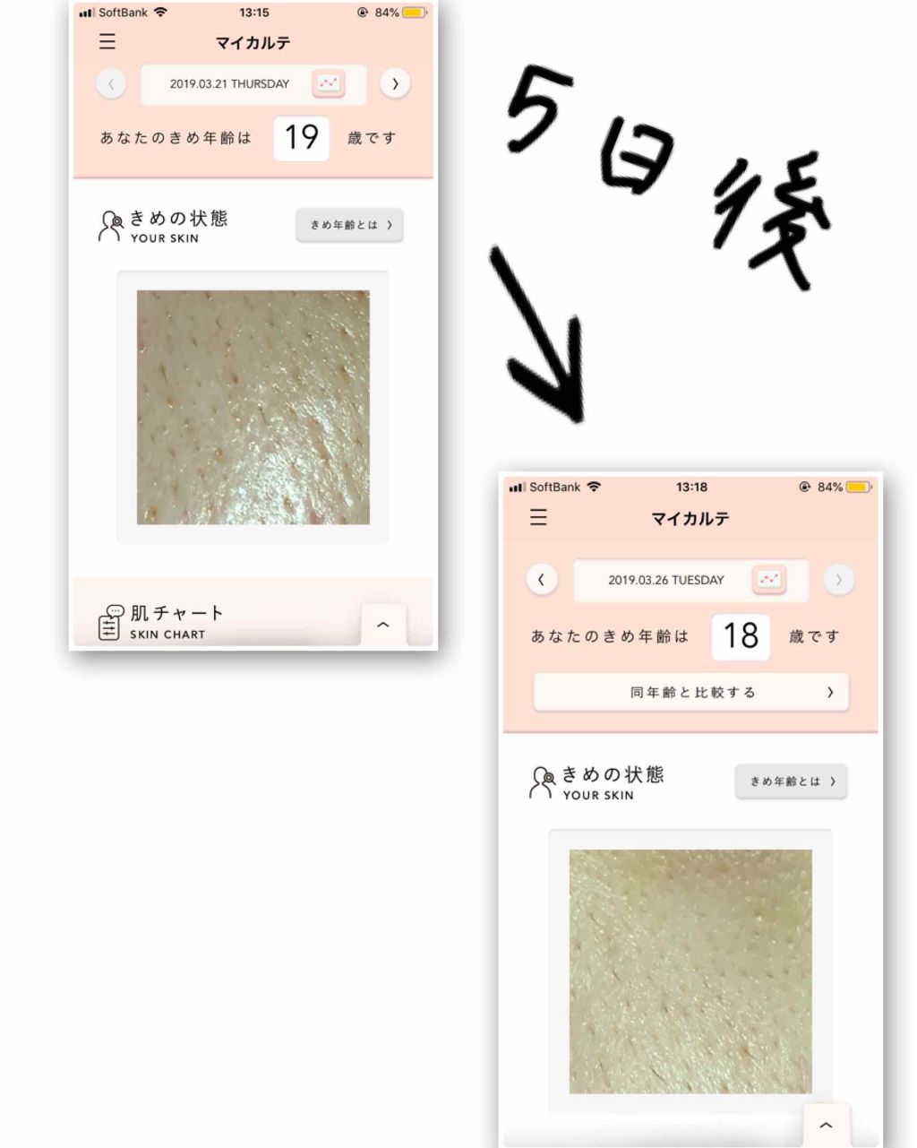 薬用しみ対策 美白化粧水/メラノCC/化粧水を使ったクチコミ（3枚目）