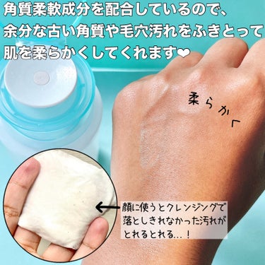 アキュネ 薬用ふきとりローションU/アキュネ/拭き取り化粧水を使ったクチコミ（7枚目）