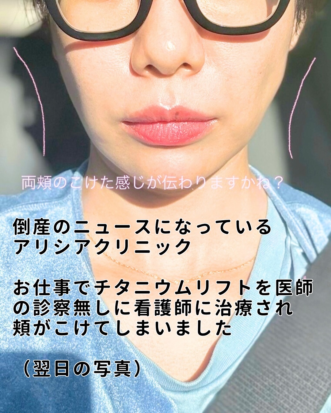 フラッフィーブラーティント/2aN/リップティントを使ったクチコミ（2枚目）