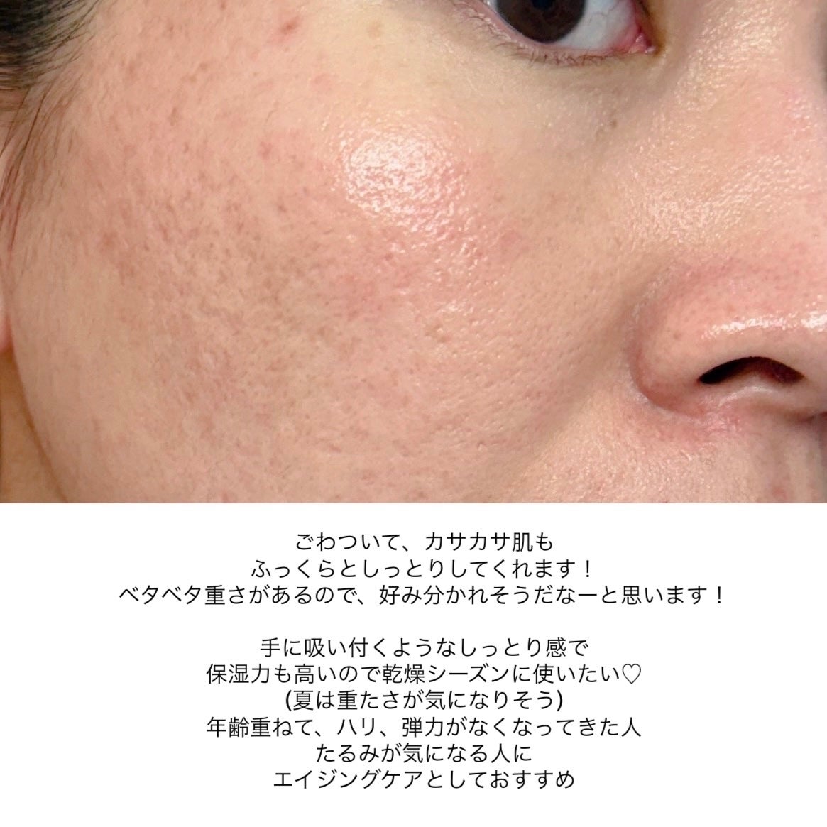 ナイトセラム /リバイタル/美容液を使ったクチコミ(5枚目)