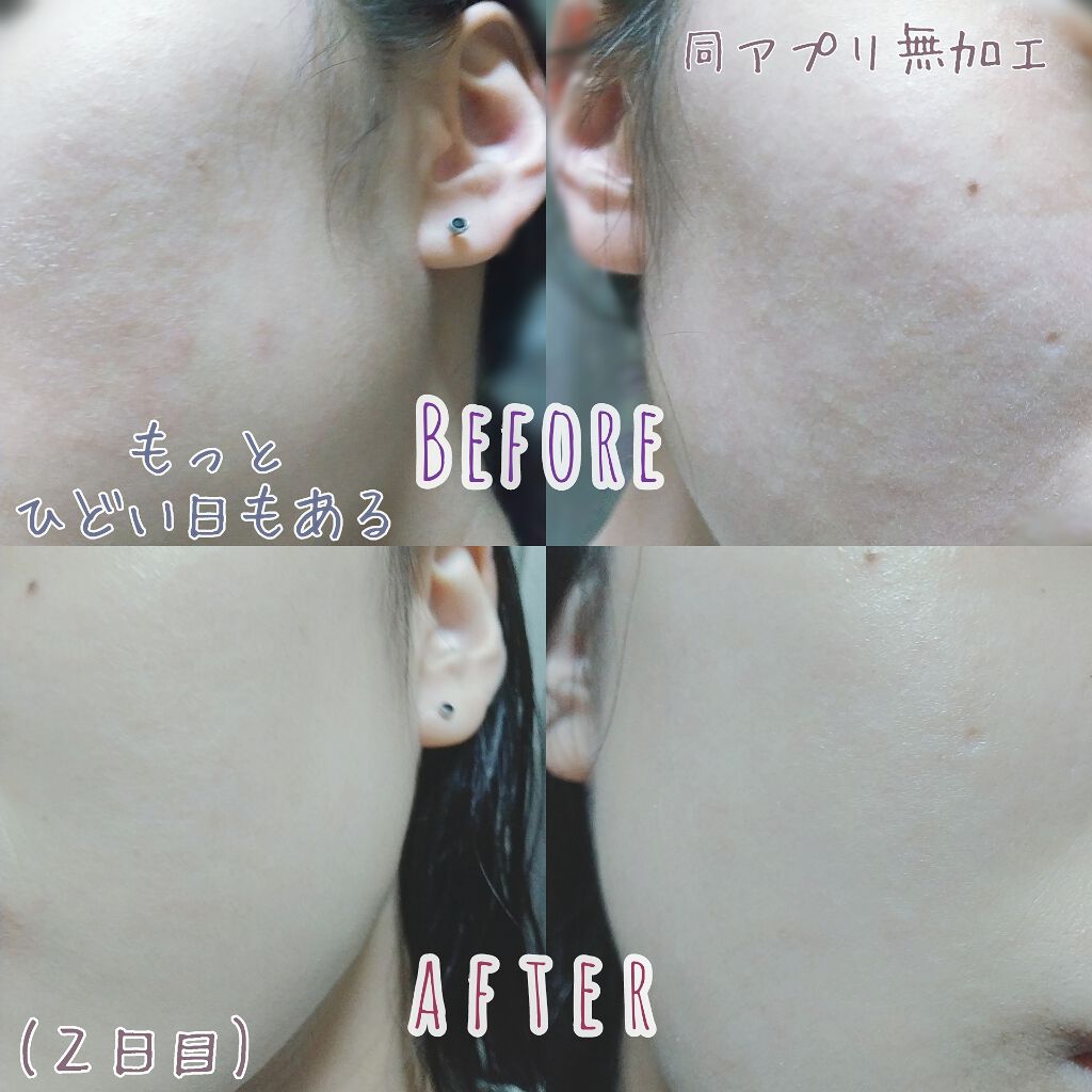 ローヤルゼリー配合 栄養ローション/DAISO/美容液を使ったクチコミ(2枚目)