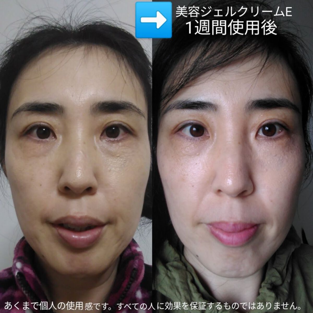 ピリオドスキンケア 美容ジェルクリーム マンスリーセット /MERIN/スキンケアキットを使ったクチコミ（3枚目）